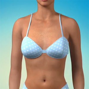 Cosmetic Breast Surgery Picture
